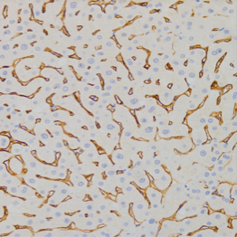 DC-SIGN staining of FFPE human liver