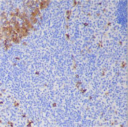 CD138-IHC-staining-FFPE-human-tonsil