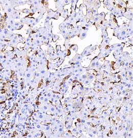 CD206-IHC-staining-FFPE-human-liver