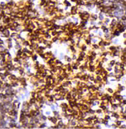 CD3-[MRQ39]-IHC-staining-FFPE-human-thymus