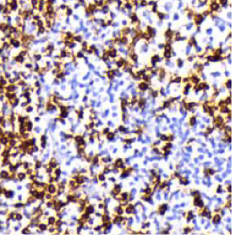 CD3-MRQ39-IHC-staining-FFPE-human-tonsil