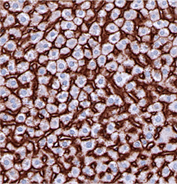 Na-K-ATPase-IHC-staining-FFPE-human-liver