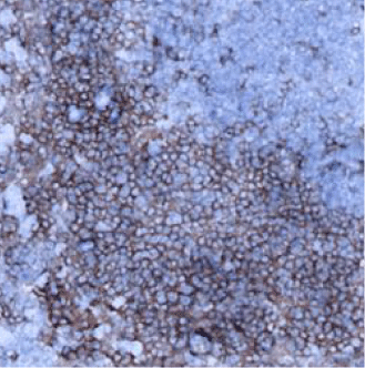 B220-IHC-staining-fresh-frozen-mouse-spleen
