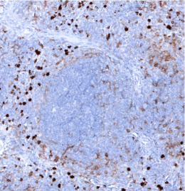 CD11b-IHC-staining-FFPE-mouse-spleen