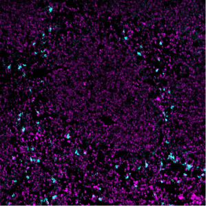 CD11b-Ionpath-MIBI-staining-fresh-frozen-mouse-spleen