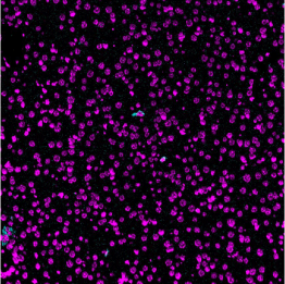 CD11c-Ionpath-MIBI-staining-FFPE-mouse-liver