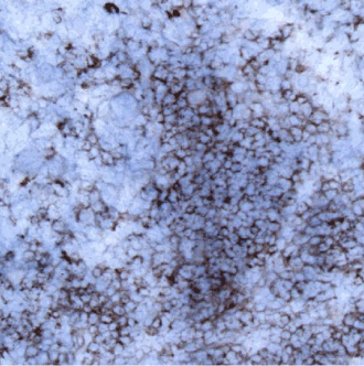 CD3-IHC-staining-fresh-frozen-mouse-spleen