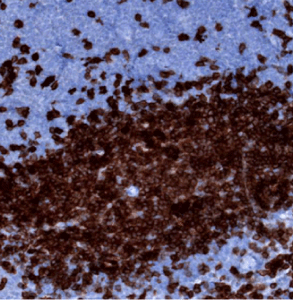 CD3e-IHC-staining-FFPE-mouse-spleen