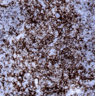 CD4-IHC-staining-fresh-frozen-mouse-spleen