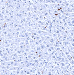 CD49b-IHC-staining-FFPE-mouse-liver