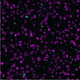 CD49b-Ionpath-MIBI-staining-FFPE-mouse-liver
