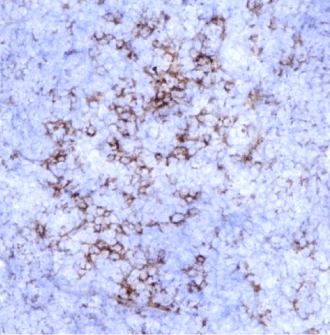 CD8-IHC-staining-fresh-frozen-mouse-spleen
