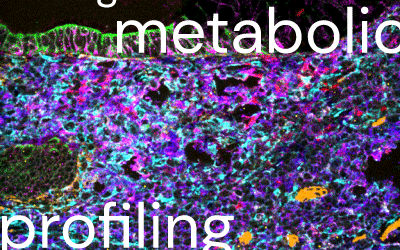 Stanford Scientists Use MIBI Technology to Study Single-Cell Metabolic Profiles in Colorectal Carcinoma