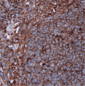 β-tubulin-IHC-staining-FFPE-mouse-spleen