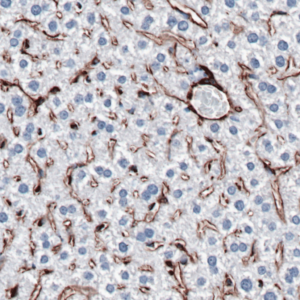 Vimentin-IHC-staining-FFPE-mouse-liver