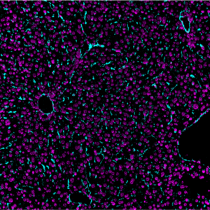 CD31-Ionpath-MIBI-staining-FFPE-mouse-liver