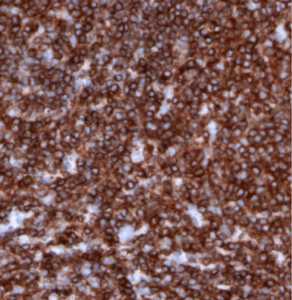 CD45-IHC-staining-FFPE-mouse-spleen