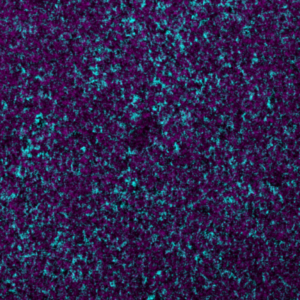 CD45-Ionpath-MIBI-staining-FFPE-mouse-spleen