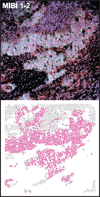 Human SCLC Atlas Study | Chan et al. Cancer cell | Fig4EF