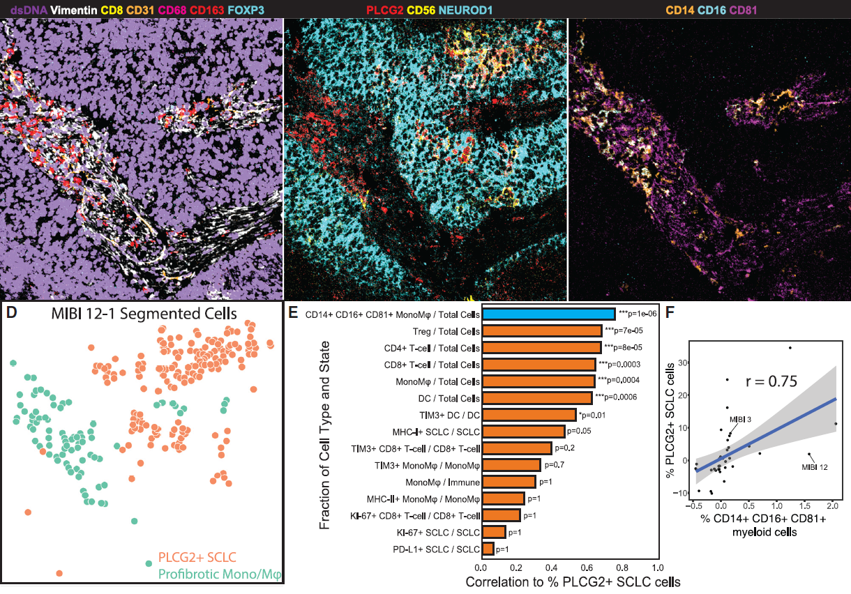 Human SCLC Atlas Study | Chan et al. Cancer cell | Fig7CDEF