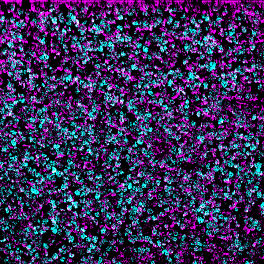 Helios-Ionpath-MIBI-staining-FFPE-human-T-cell-lymphoma