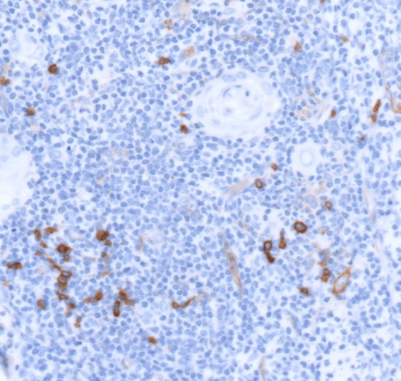 CD123-IHC-staining-FFPE-human-thymus