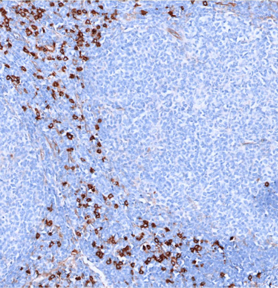 CD123-IHC-staining-FFPE-human-tonsil