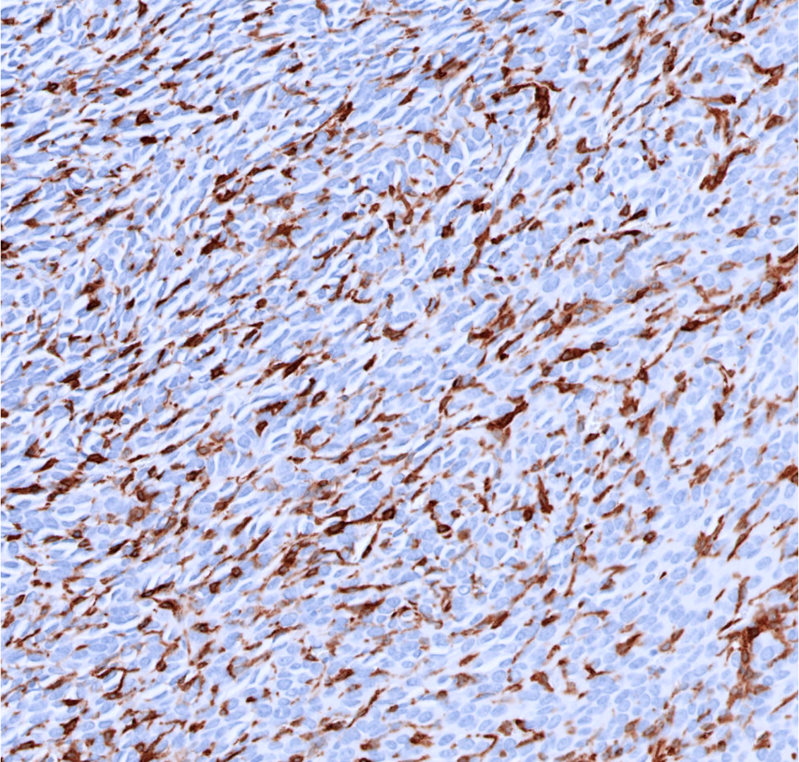CD206-IHC-staining-FFPE-mouse-CT26-tumor