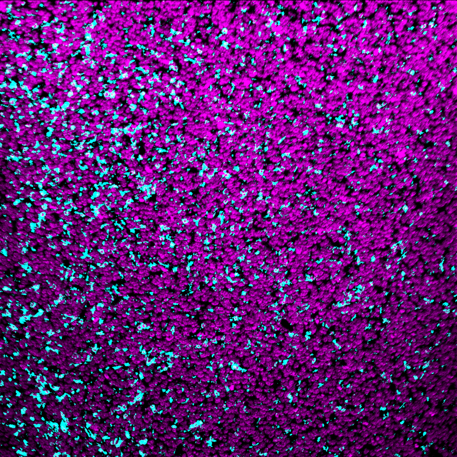 CD206-Ionpath-MIBI-staining-FFPE-mouse-CT26-tumor