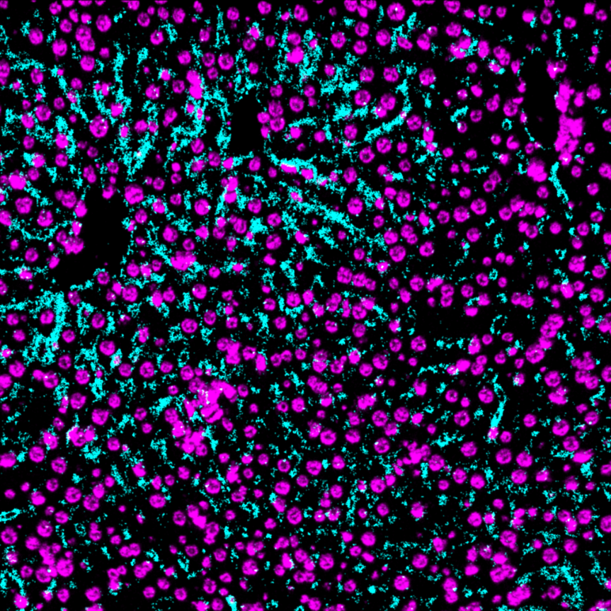 CD206-Ionpath-MIBI-staining-FFPE-mouse-liver