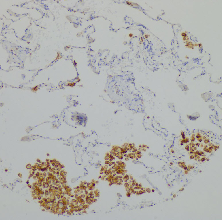 CD11c-IHC-staining-FFPE-mouse-liver