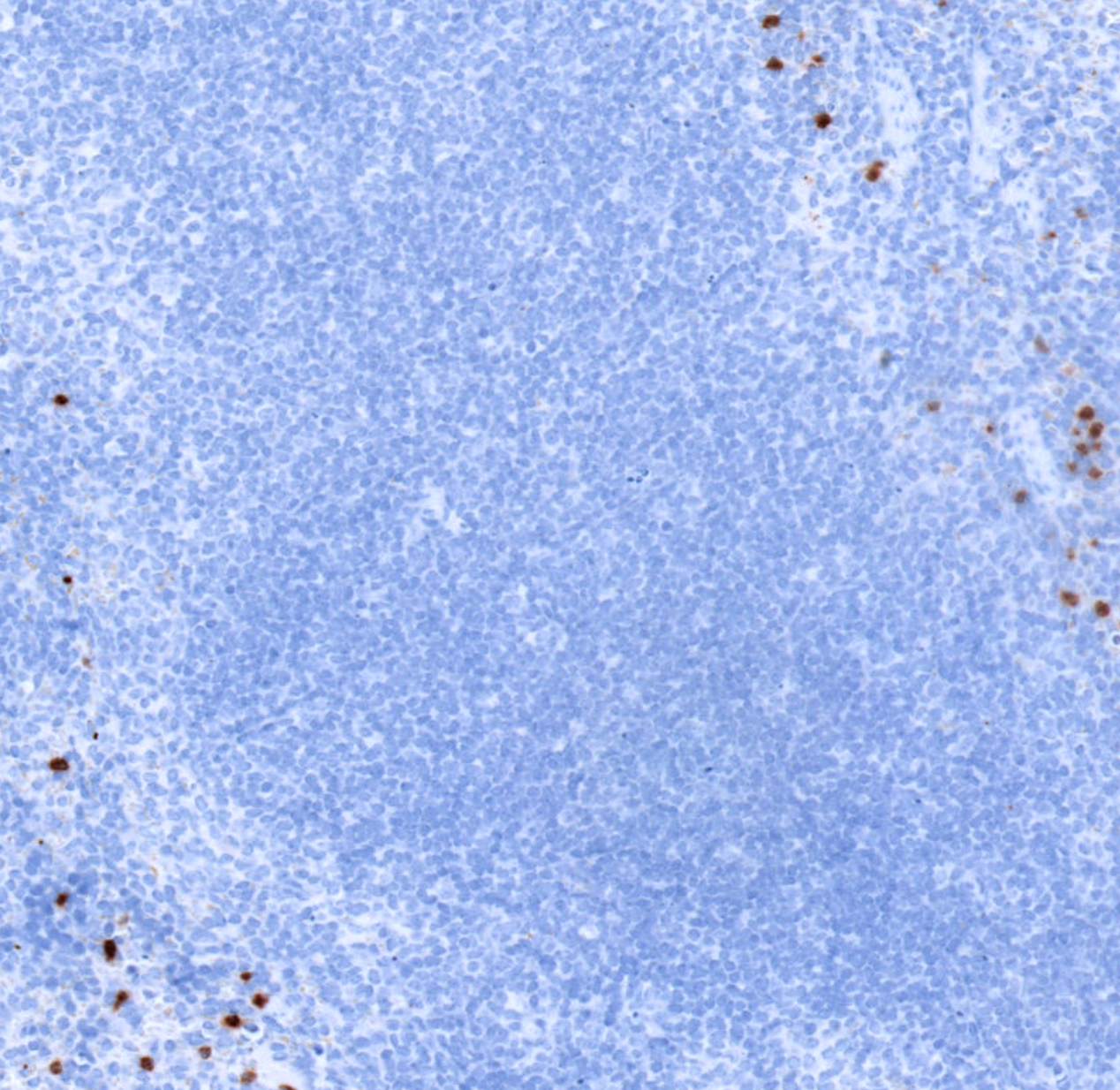 Ly6G-IHC-staining-FFPE-mouse-spleen