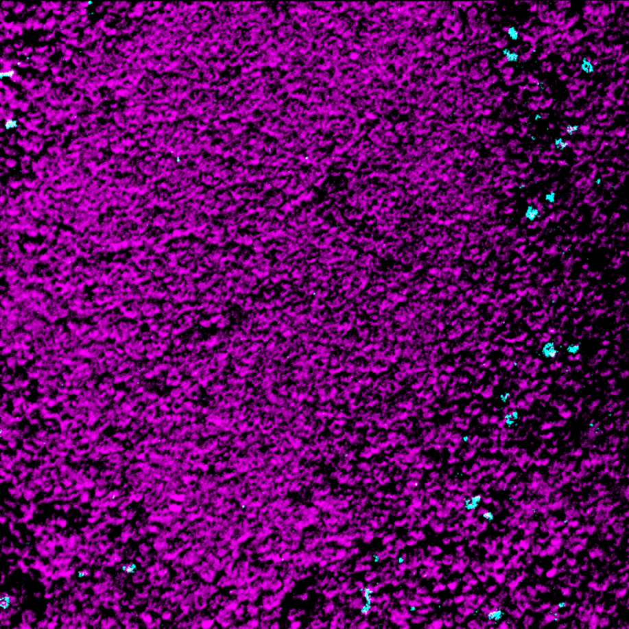 Ly6G-IHC-staining-FFPE-mouse-spleen