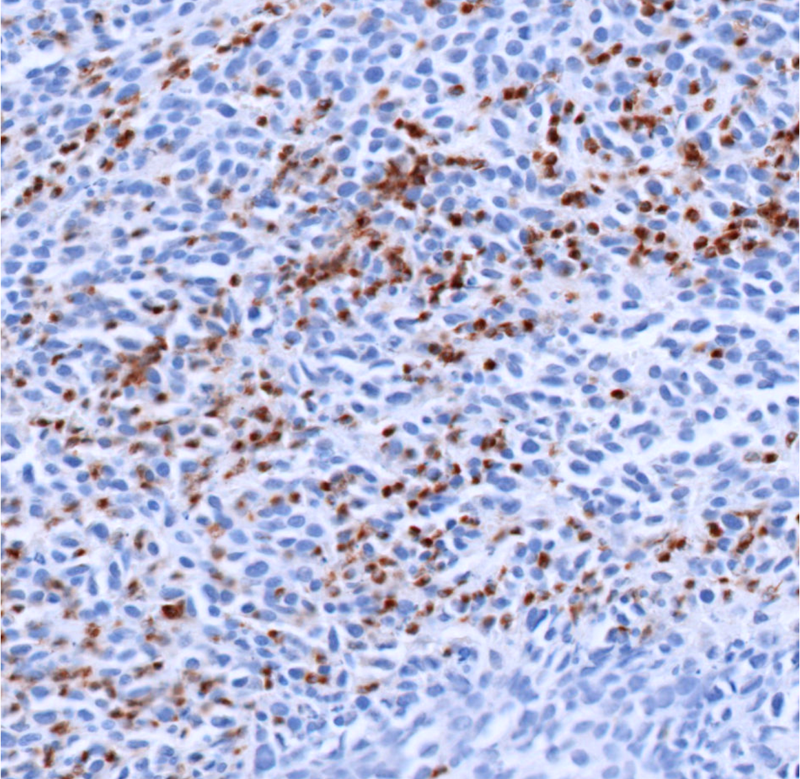 Ly6G-Ionpath-MIBI-staining-FFPE-mouse-spleen