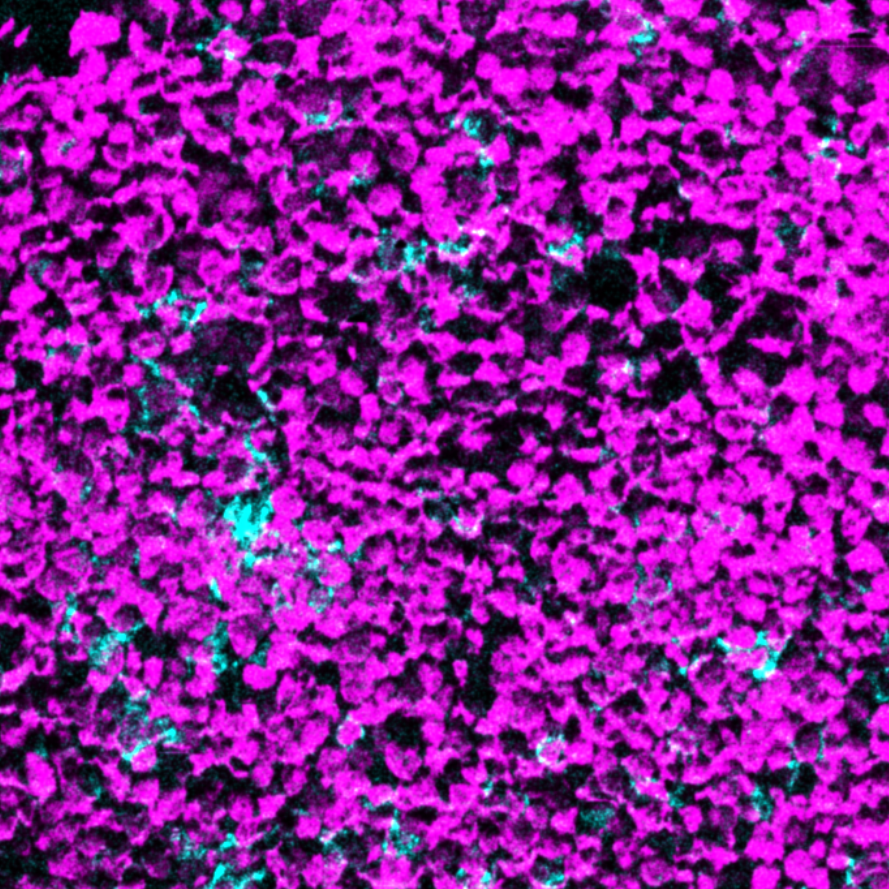CD8-Ionpath-MIBI-staining-FFPE-mouse-ileum